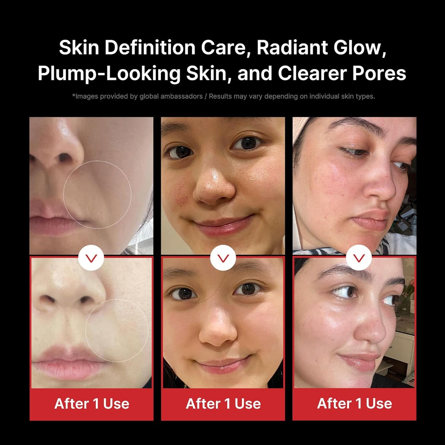 Medicube AGE-R Booster Pro — Dispositivo Facial 6 em 1 | Skincare Coreano