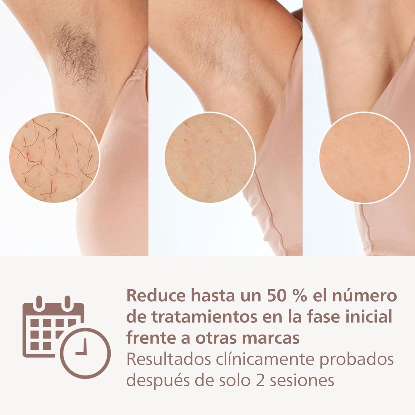 Philips Lumea Série 8000 BRI949/00 — Depilação IPL | Tecnologia SenseIQ | Pele Lisa até 18 Meses